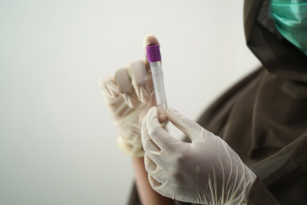 Photo of a doctor holding a tube with a sample like what happens when your Cartagena covid test location sends your sample to a lab.