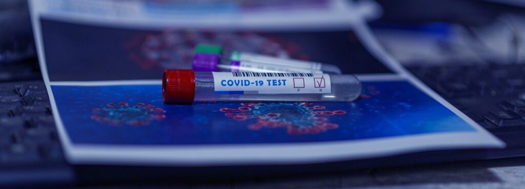 Photo of a test tube that says Covid-19 test in Cartagena.