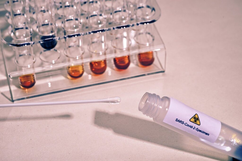 Photo of a lab analyzing a Covid specimen for a PCR test in Cartagena Colombia.